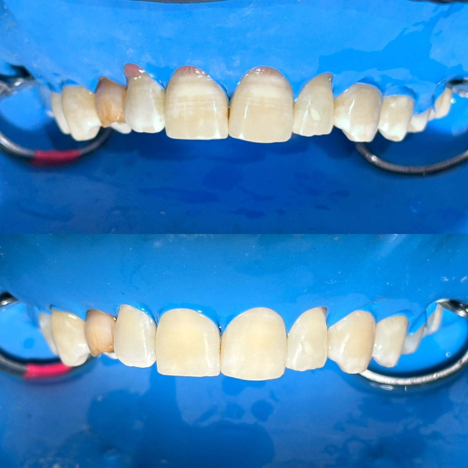 Dental